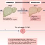 HFpEF与MASLD：机制的交汇与临床意义